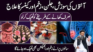 Intestine Infection Ka ilaj  Intestinal Inflammation  Anton Ki Sozish Ka ilaj Dr Sharafat Ali 2024 [upl. by Trixie]