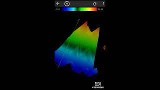 Android Gradiometer Using [upl. by Stone]