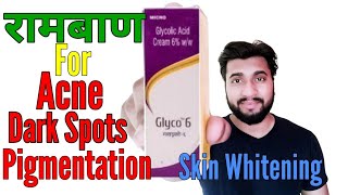 Acne Scars Pimple Marks Pigmentation Skin Whitening By Glyco 6 Cream Glycolic Acid Review [upl. by Lorola]