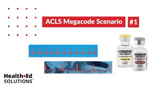 ACLS Megacode Scenario 1 Supraventricular Tachycardia SVT [upl. by Pedrotti]