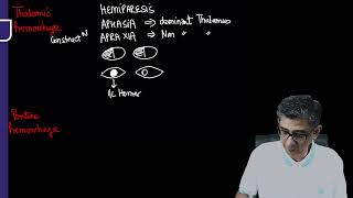 Clinical features of Intracerebral Hemorrhage Revision for FMGE NEET PG by Dr Deepak Marwah [upl. by Aidualc]