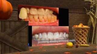 KoR Teeth Whitening System [upl. by Nekal]