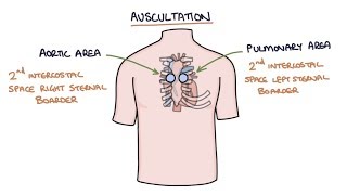 Heart Murmurs and Heart Sounds Visual Explanation for Students [upl. by Eleinad]