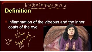 Endophthalmitis  Dr Niha Aggarwal [upl. by Ehpotsirhc652]