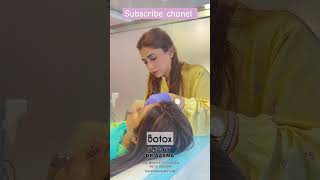 Botox Before And After Result Watch Till End foryou botox botoxfillers yt [upl. by Anemix]