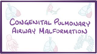 Congenital pulmonary airway malformation  an Osmosis preview [upl. by Eniad]