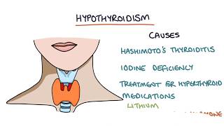 Hypothyroidism and Hashimotos Thyroiditis Visual Explanation for Students [upl. by Jamnes147]