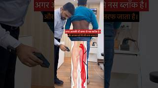 Sciatica pain treatment by dr harish grover trend feed feedshort [upl. by Annayehc]