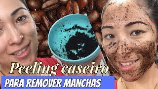 PEELING CASEIRO PARA MANCHAS E CRAVOS de café [upl. by Hyozo]