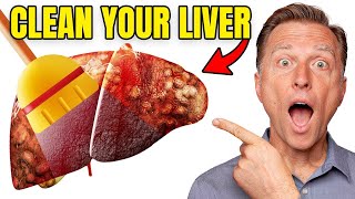 Top BEST Foods to Clean Out Your Liver [upl. by Esinel]