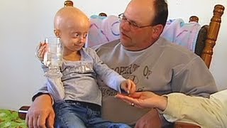 Progeria clinical trial at Boston Childrens Hospital [upl. by Atselec]