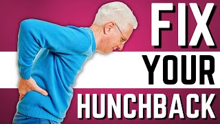 Top 10 Exercises to Stop Hunchback Kyphosis Forward Head Posture [upl. by Broome]