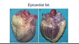 CARDIOVASCULAR PART TWO THE HEART episode 2 [upl. by Eresed]