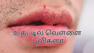 உதட்டில் வெள்ளை புள்ளிகள்lips [upl. by Uzzia342]