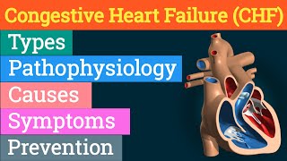 Congestive Heart Failure  Types Of CHF  Causes Symptoms amp Prevention Of CHF  CHF in hindi [upl. by Joellen]