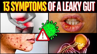 13 Symptoms Of A Leaky Gut [upl. by Keligot]