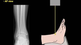 Anatomy of Ankle Xrays [upl. by Eckhardt852]