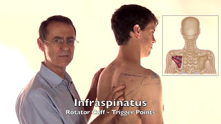 Trigger Point Release  Infraspinatus Muscle [upl. by Wehttan]