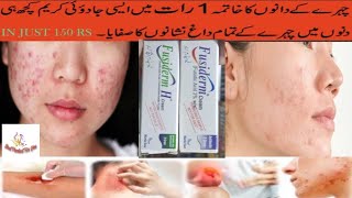 Fusiderm Cream Uses In urdu  Fusiderm Cream How to Use  Best product for you [upl. by Wagoner]