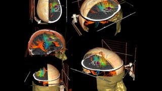 How a Mri scan is Done [upl. by Durrett]