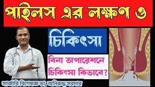 পাইলসের লক্ষণ ও চিকিৎসা। ডাঅনিরুদ্ধ সরদার।Piles symptoms amp Treatment Bangla [upl. by Dnaltroc]