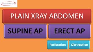 ABDOMEN XRAY  MADE EASY  MBBS FINAL YEAR  PRACTICAL EXAMS [upl. by Suiradel158]