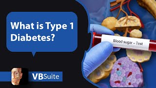 Visible Body  What is Type 1 Diabetes [upl. by Myers]