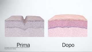 Fillerina Biorevitalizing  Trattamento effetto filler dermocosmetico ed effetto biorivitalizzante [upl. by Roice]