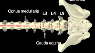 Lumbar Puncture [upl. by Joannes756]