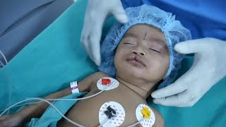 Intubation Procedure for a Pediatric Child by Expert Anesthesia Doctors at Richardsons [upl. by Enelear922]