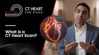 What Is A CT Heart Scan [upl. by Orgel698]