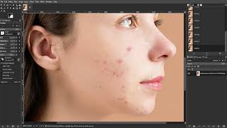 How to Fix Skin Blemishes in GIMP [upl. by Boleslaw728]