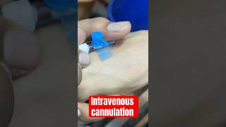 iv cannulation  baby ivcannulation subscribe ivtherapy mbbs SMpharmacy plz follow [upl. by Reivaj]