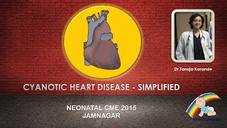 Cyanotic Heart Disease  Simplified By Dr Tanuja Karande [upl. by Derman]