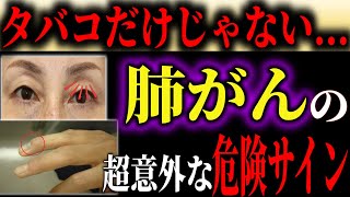 【肺がん】絶対に見逃さないで！タバコだけじゃない！意外すぎる肺がんの症状とは？【予防医学】【医学】【健康】【医療】【本の要約】【がん】 [upl. by Buskus363]