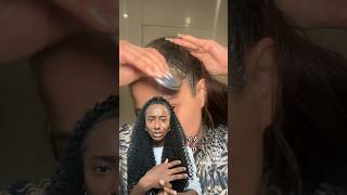 Scalp PsoriasisScalp Eczema [upl. by Moise]