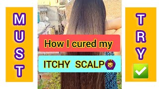 Scalp itching home remedy  Scalp itching treatment [upl. by Notlew]