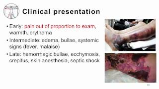 1 Fasciitis and Myositis [upl. by Attenoj]