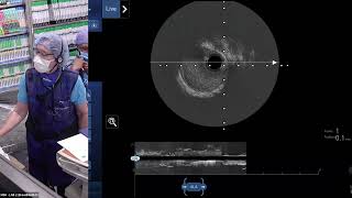 Learn From The Masters  Managing Calcified Bifurcation Coronary Lesions June 2024 [upl. by Epuladaugairam]