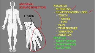 Somatosensory symptoms and signs [upl. by Zehcnas]