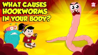 What causes Hookworm। Intestinal Worms Symptoms and Treatment  Worm Infection  Dr Binocs Show [upl. by Groome789]