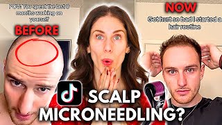 Can You Grow Back Hair With Scalp Microneedling Does Scalp Microneedling Work [upl. by Piwowar974]