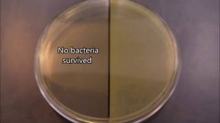 UV effects on bacteria timelapse [upl. by Martha646]