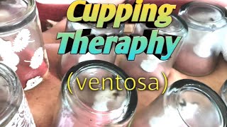 How to do ventosa CUPPING THERAPHY2020 [upl. by Haisej]