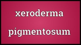 Xeroderma pigmentosum Meaning [upl. by Rosena]