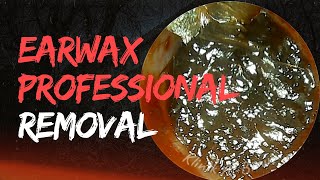 Jelly Like Earwax Professional Removal [upl. by Latsryc]