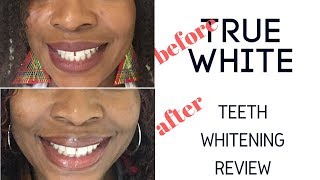 TrueWhite Teeth Whitening Review [upl. by Irakuy]