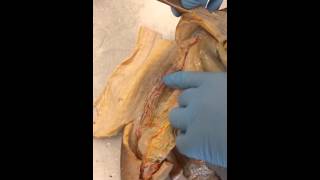 Urogenital system of female dogfish shark [upl. by Eanahc]