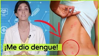 ¡Me dio dengue [upl. by Zacherie]