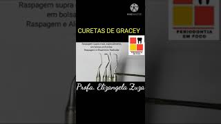 CURETAS DE GRACEY [upl. by Juliano725]